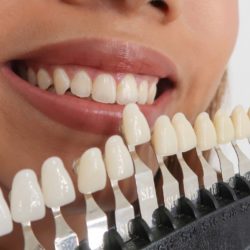 Get up to 2-9 shades whiter teeth at The Smile Bar.