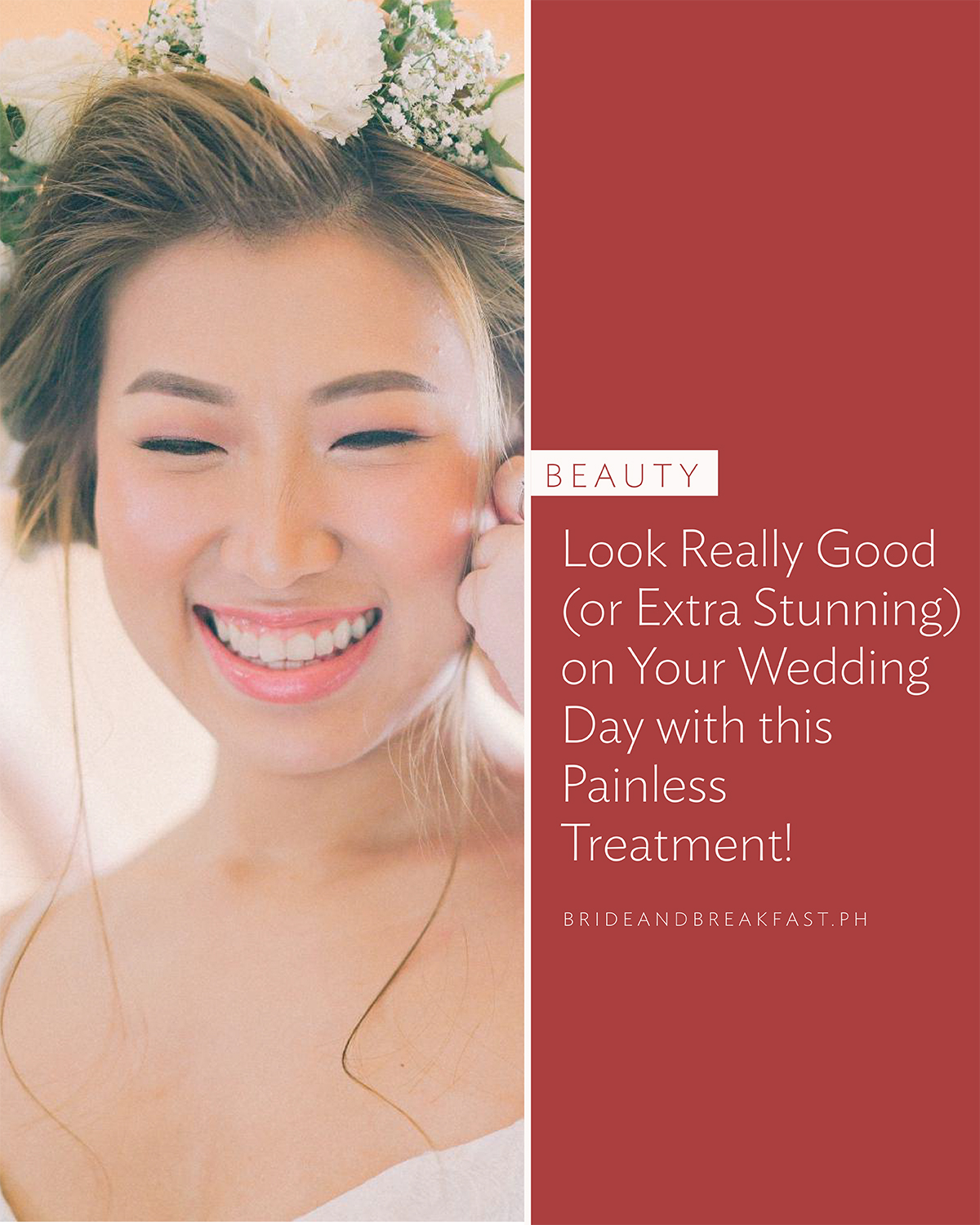 Look really good (or extra stunning) on your wedding day with this painless treatment!
