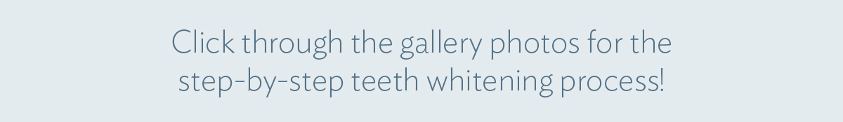 Click through the gallery photos for the step-by-step teeth whitening process!