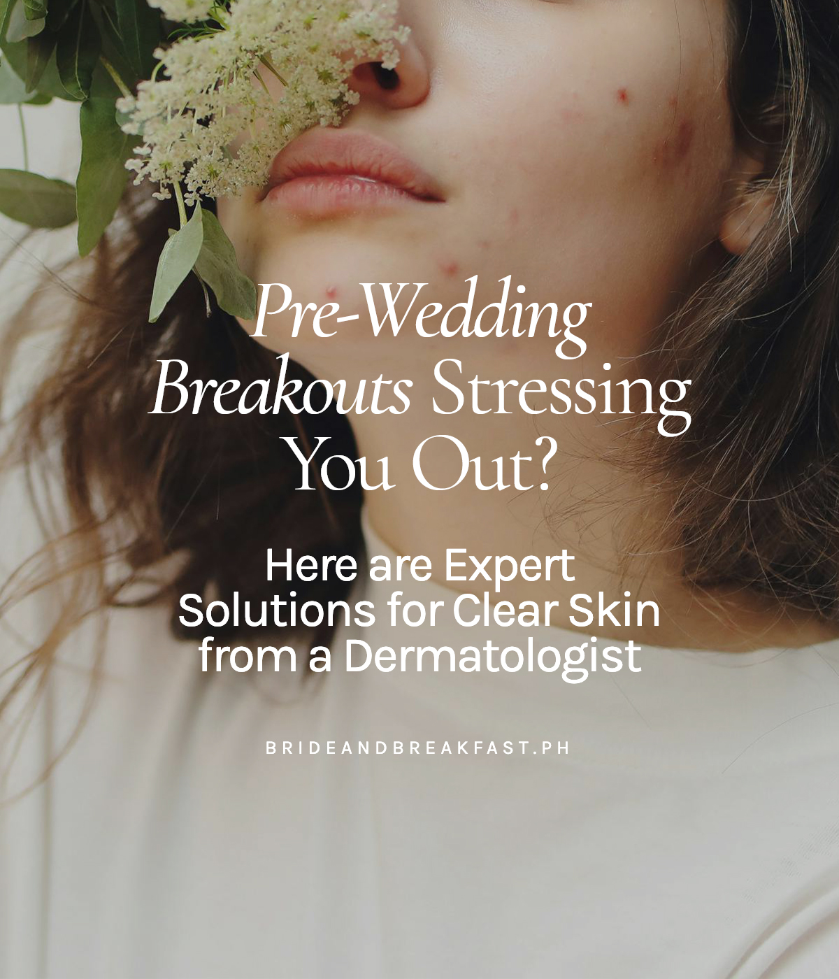 Pre-Wedding Breakouts Stressing You Out? Here are Expert Solutions for Clear Skin from a Dermatologist